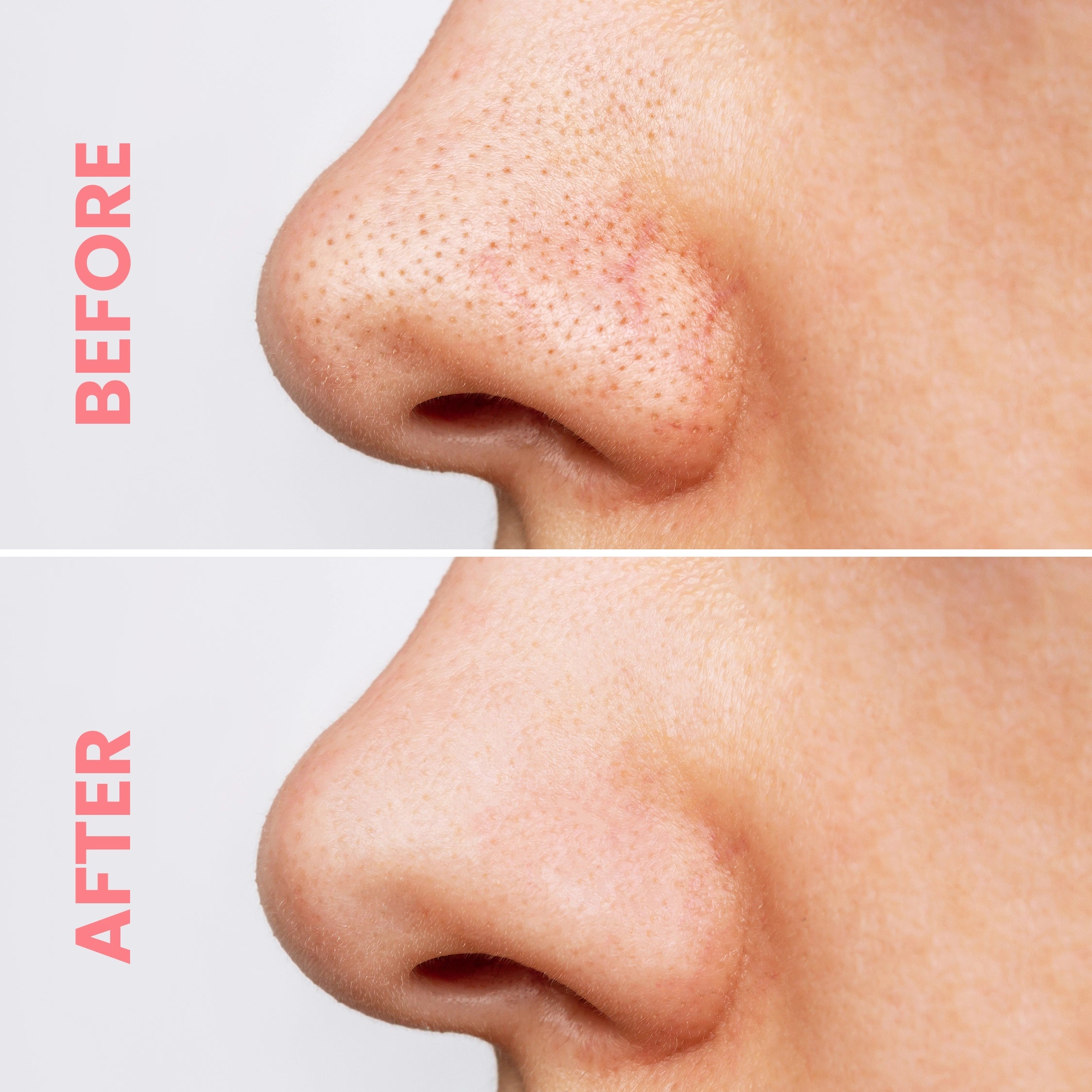 Rose Petal Nose Pore Strips